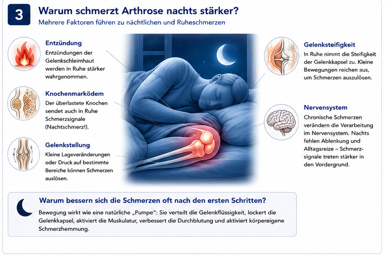 Infografik: Warum Arthrose nachts stärker schmerzen kann und warum Bewegung am Morgen häufig eine Besserung bringt.